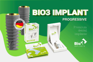 Bio3 Progressive Implant, implant Đức chính hãng, trụ implant Bio3, implant cao cấp tại Việt Nam